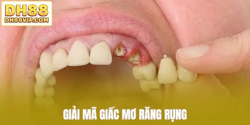 Giải mã giấc mơ răng rụng